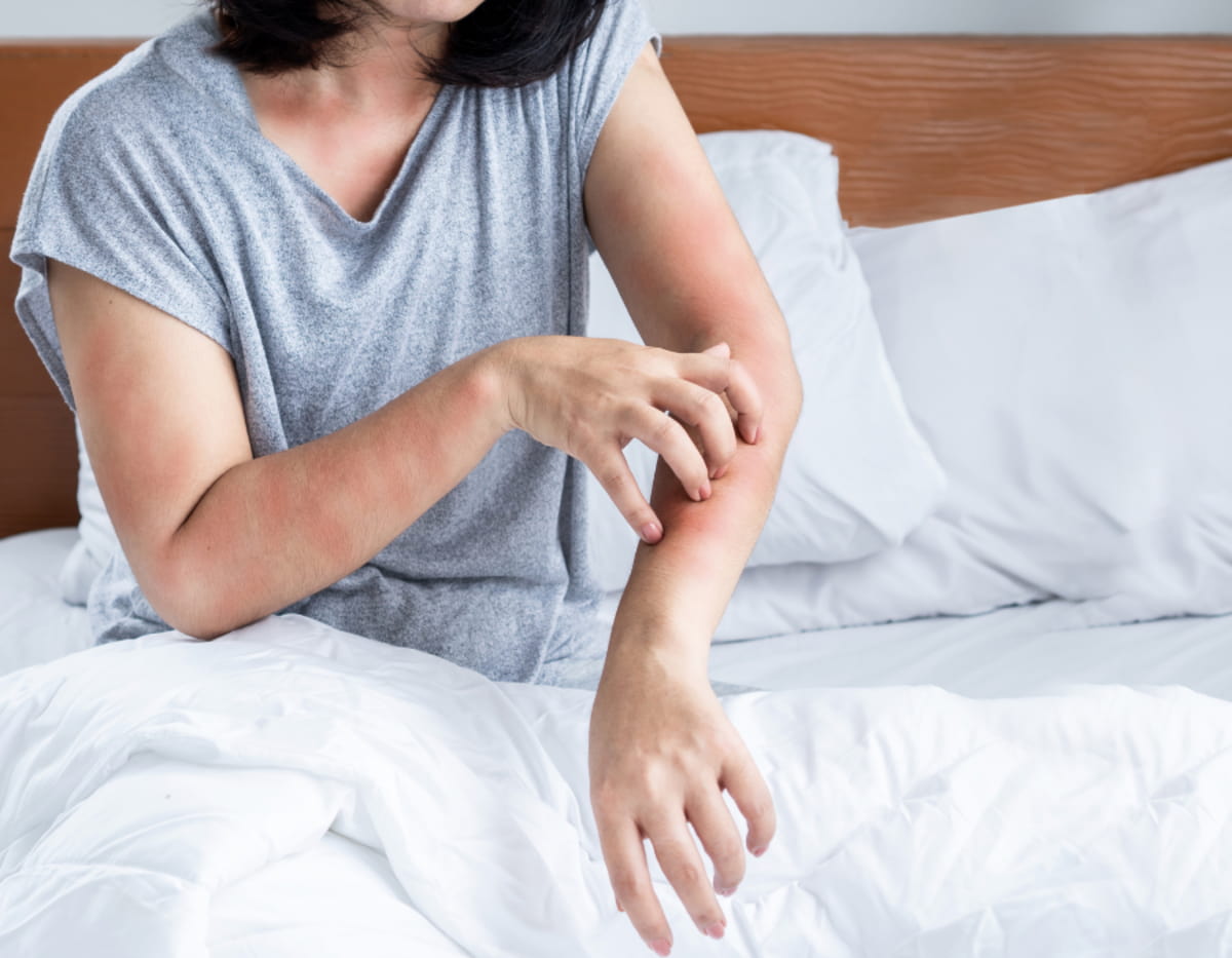 Comment éliminer les punaises de lit et prévenir leur apparition ?